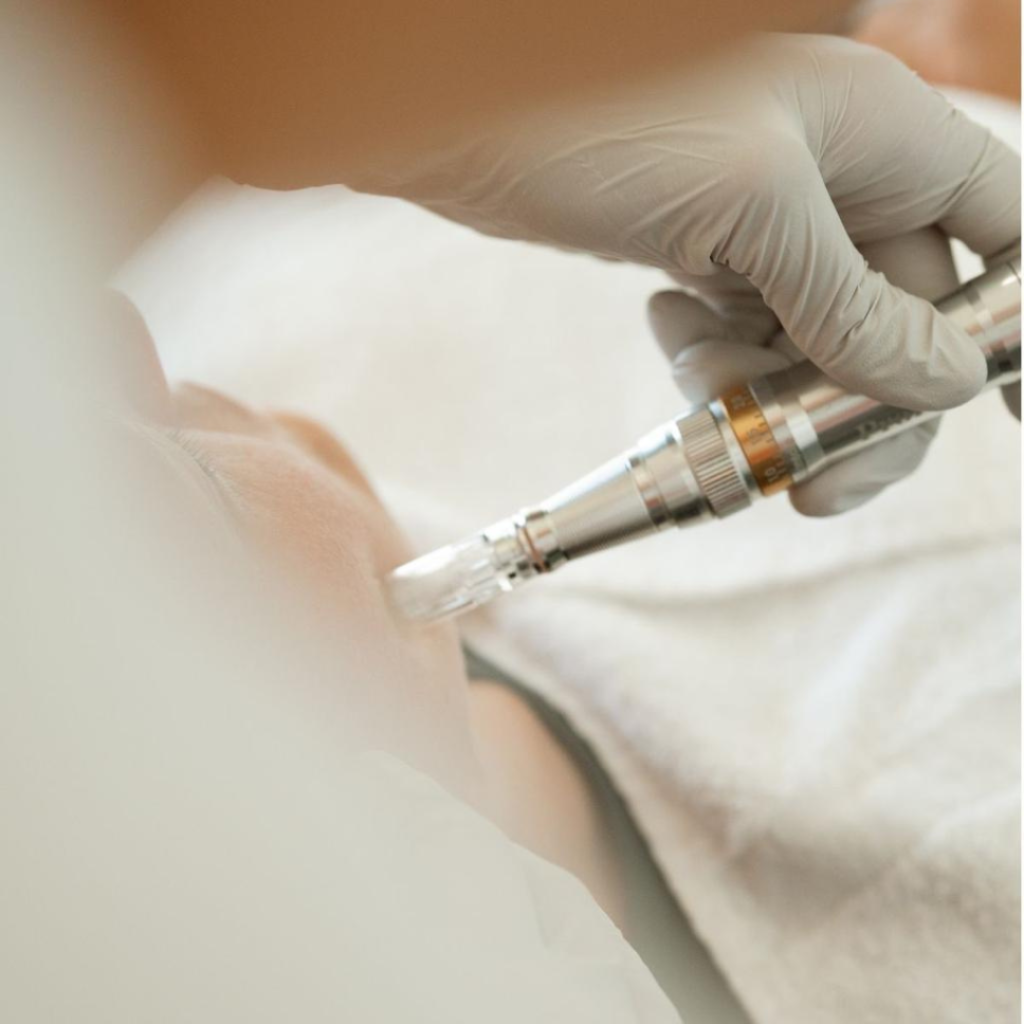 Derparment -treatment